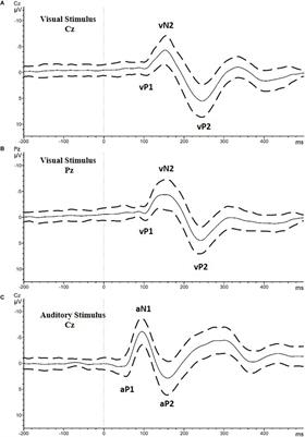 Auditory Processing Differences Correlate With Autistic Traits in Males